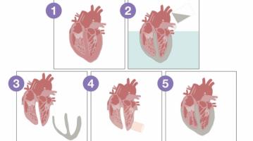 Biorobotic heart