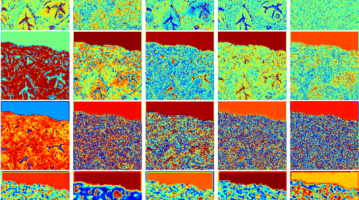 Staining biopsy slides